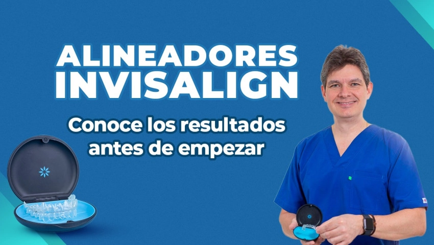 Alineadores Invisalign: Conoce los resultados antes de empezar