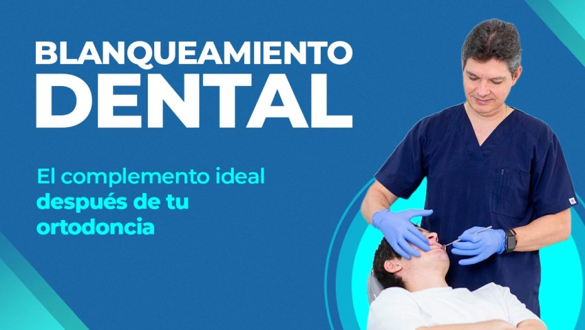 Blanqueamiento dental: El complemento ideal después de tu ortodoncia