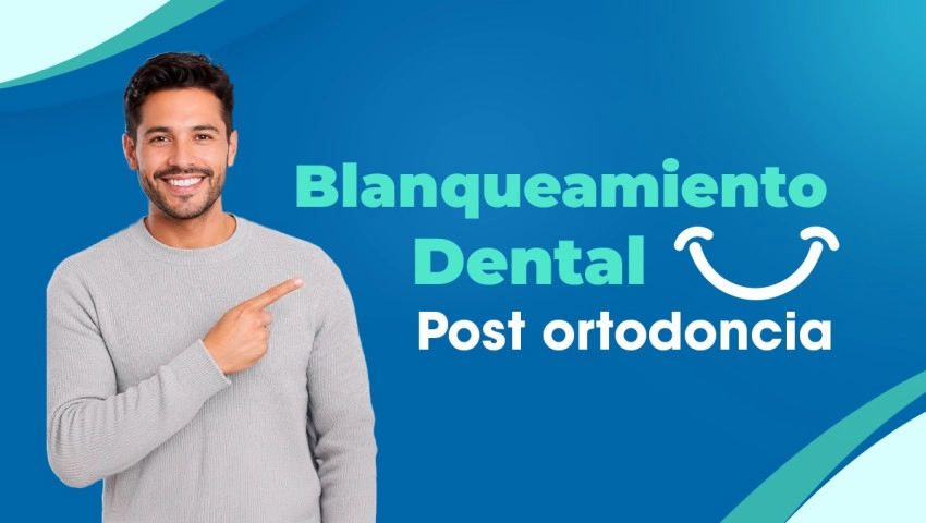 Blanqueamiento dental post-ortodoncia