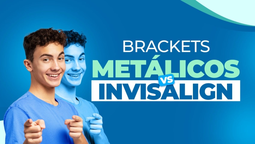 Brackets metálicos vs Invisalign
