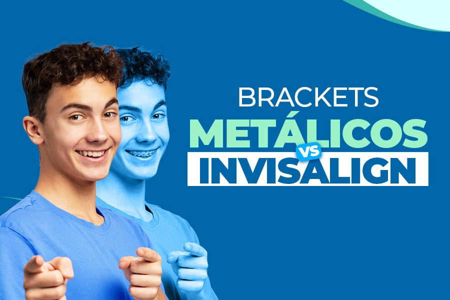 blog Brackets metálicos vs Invisalign
