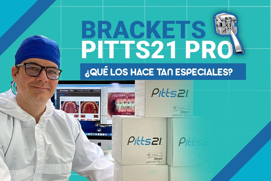 blog Brackets Pitts21 Pro ¿Qué los hace tan especiales?.