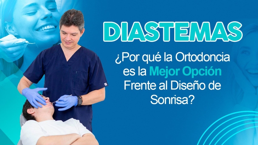Diastemas ¿Por qué la Ortodoncia es la Mejor Opción Frente al Diseño de Sonrisa?