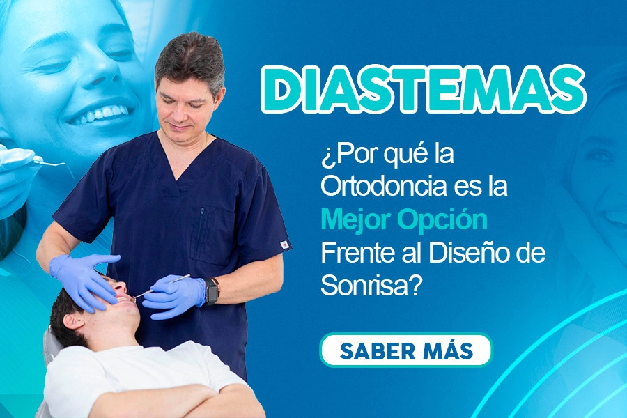 blog Diastemas ¿Por qué la Ortodoncia es la Mejor Opción Frente al Diseño de Sonrisa?