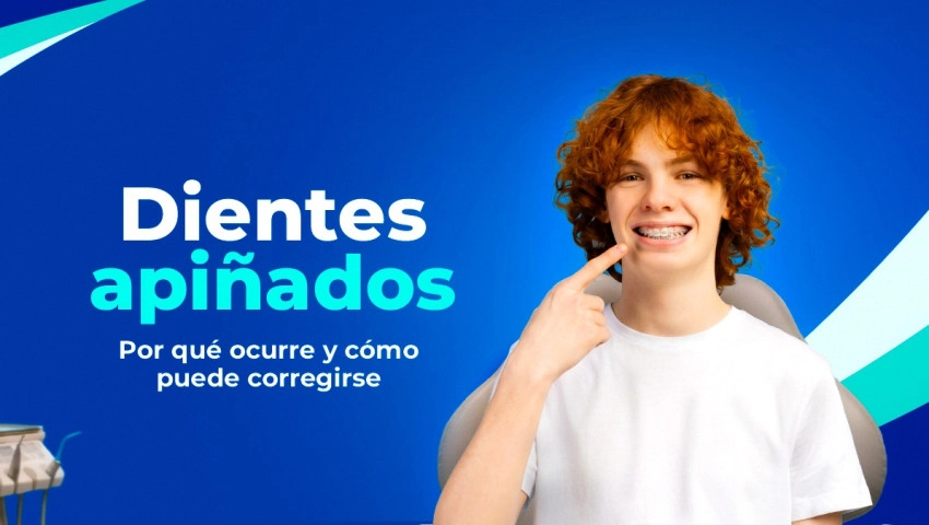 Dientes apiñados: Por qué ocurre y cómo puede corregirse