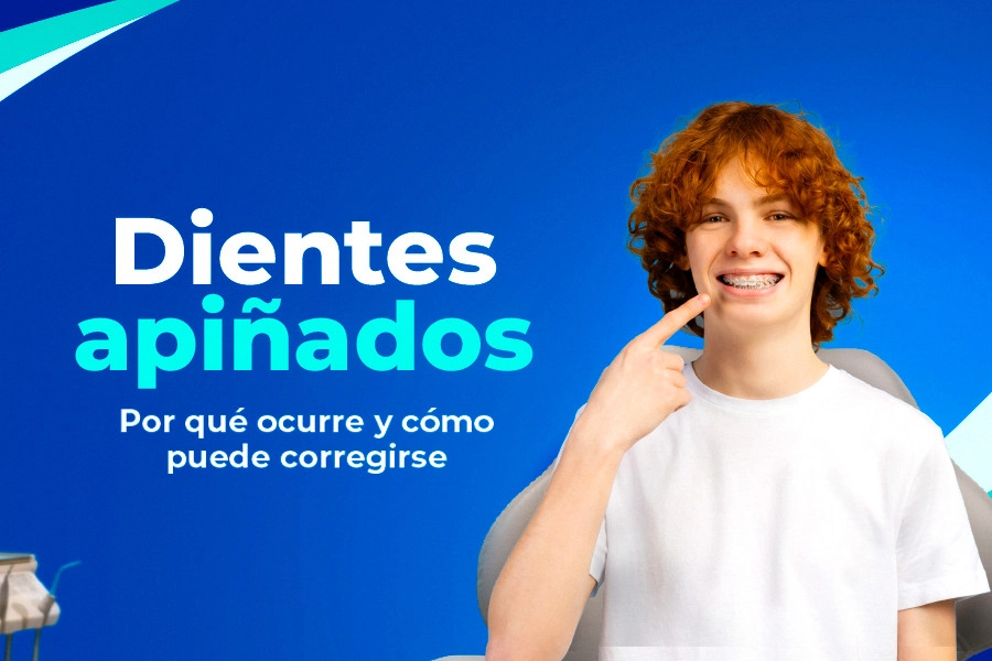 Recent post Dientes apiñados: Por qué ocurre y cómo puede corregirse