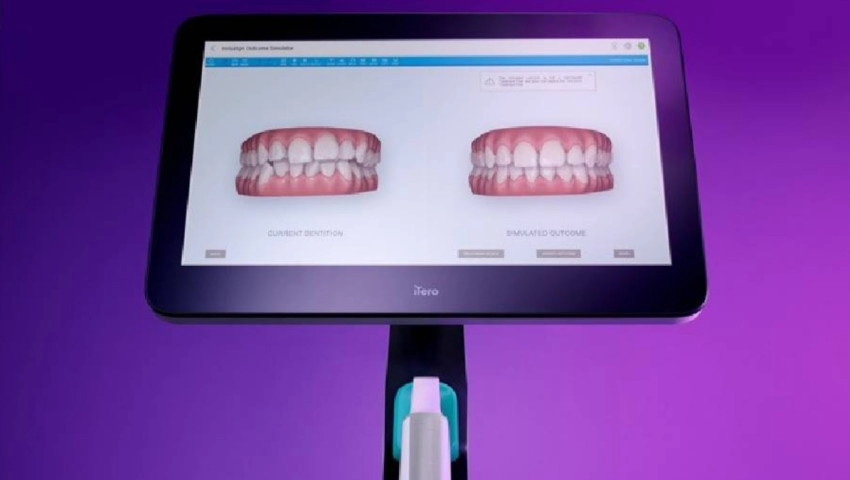 El sistema de imágenes iTero Element 5D Plus de Align Technology, premiado como «mejor innovación digital»