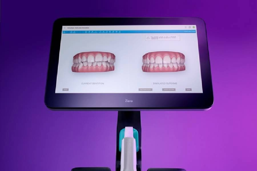 blog El sistema de imágenes iTero Element 5D Plus de Align Technology, premiado como «mejor innovación digital»