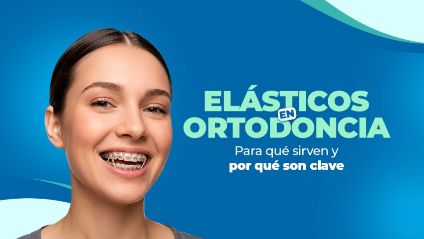 Elásticos en ortodoncia