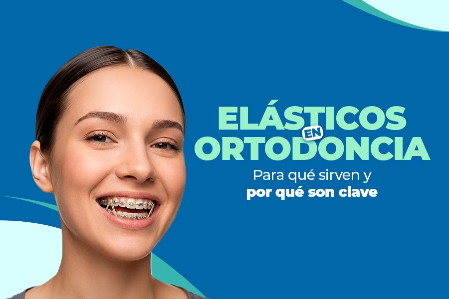 Recent post Elásticos en ortodoncia
