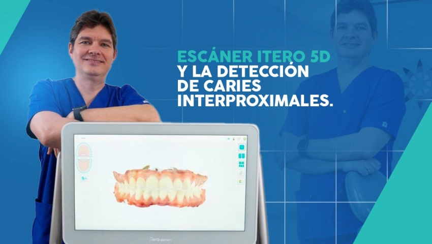 Escáner iTero 5D y la detección de caries Interproximales