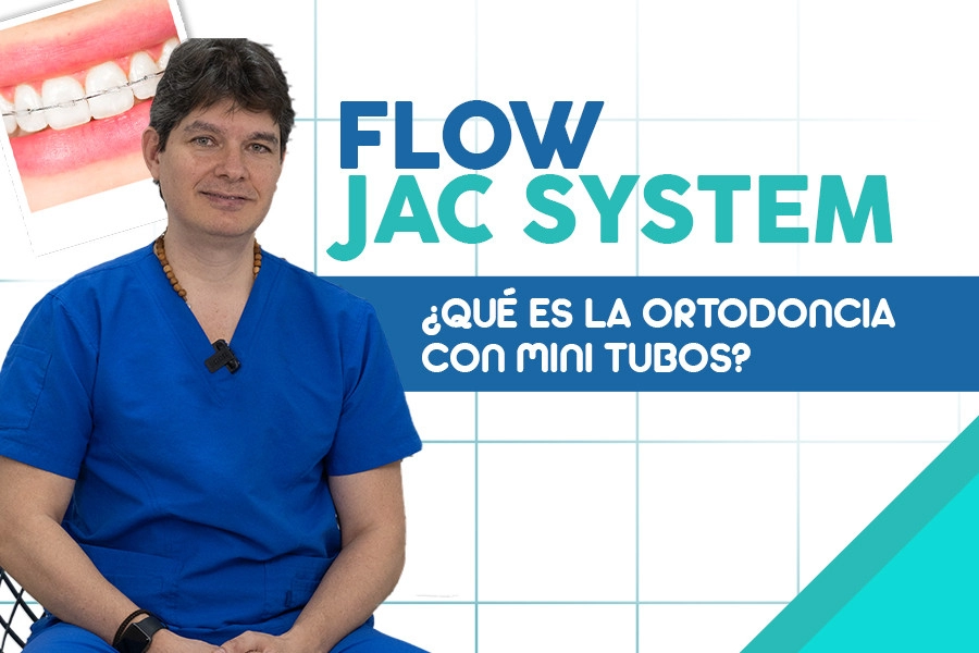 blog Flow Jac System ¿Qué es la ortodoncia con mini tubos?
