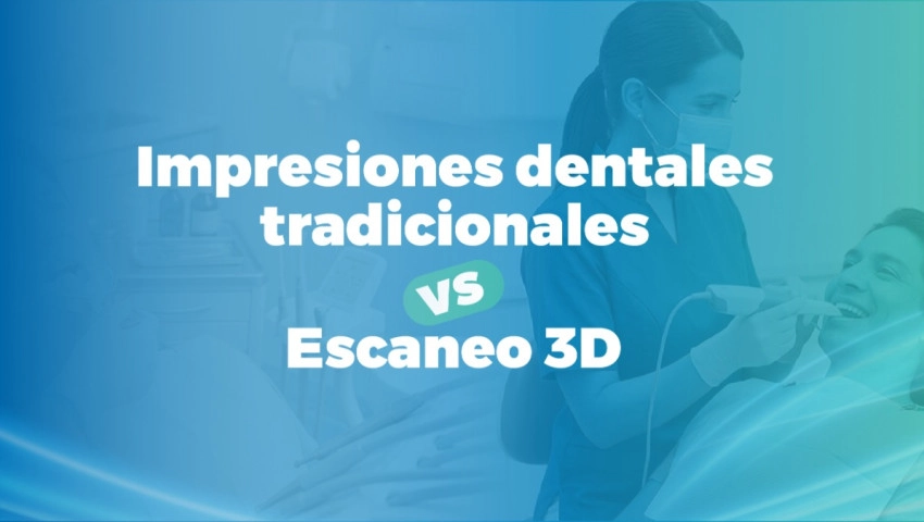 Impresiones dentales tradicionales vs. Escaneo 3D
