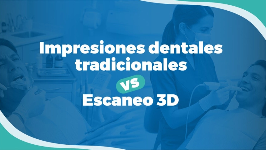 Impresiones dentales tradicionales vs. Escaneo 3D
