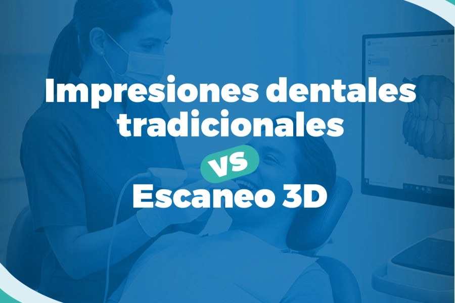 blog Impresiones dentales tradicionales vs. Escaneo 3D