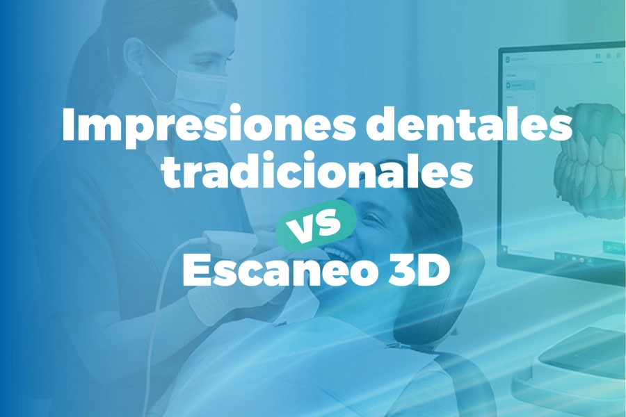 blog Impresiones dentales tradicionales vs. Escaneo 3D