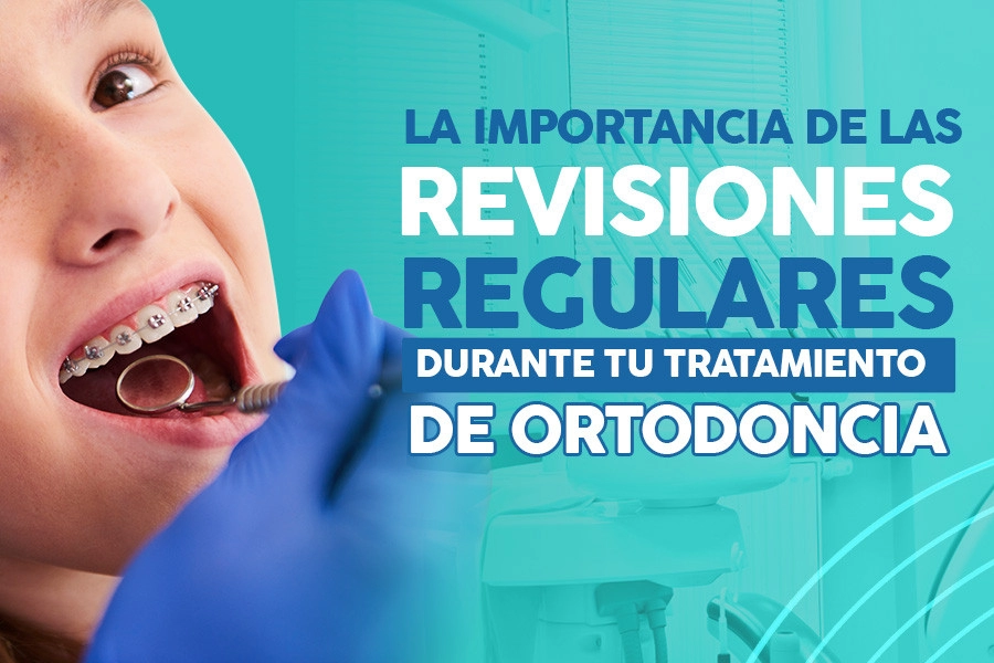 blog La Importancia de las Revisiones Regulares Durante tu Tratamiento de Ortodoncia