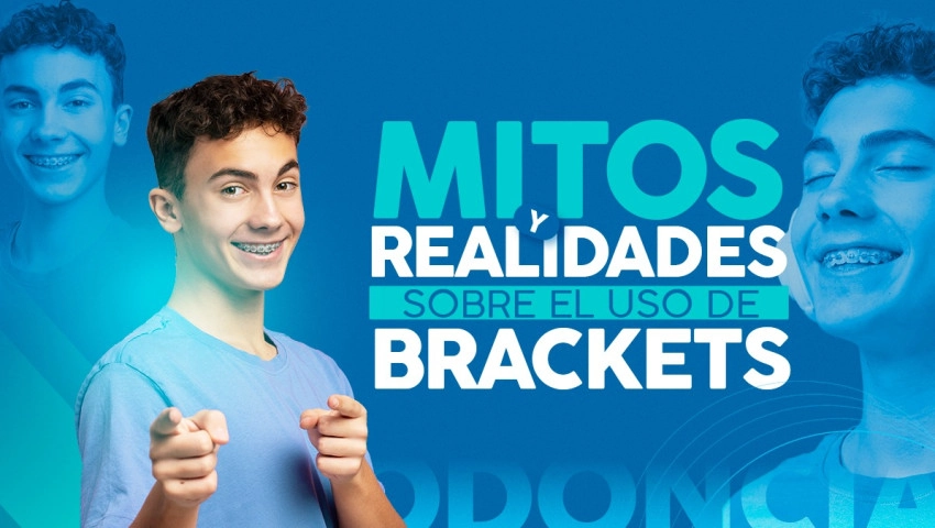 Mitos y Realidades sobre el Uso de Brackets
