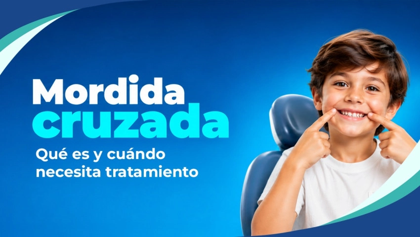 Mordida cruzada: Qué es y cuándo necesita tratamiento