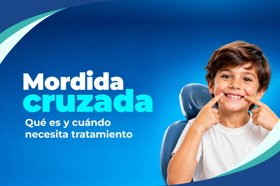 Recent post Mordida cruzada: Qué es y cuándo necesita tratamiento