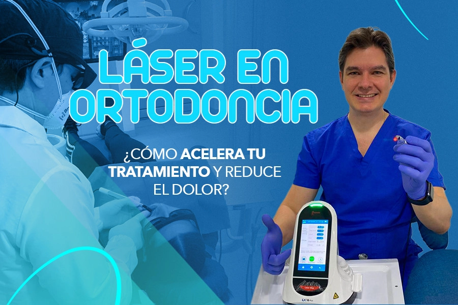 blog Láser en Ortodoncia ¿Cómo Acelera tu Tratamiento y Reduce el Dolor?