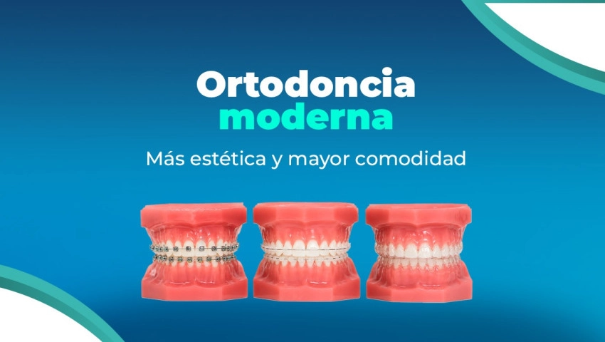 Ortodoncia moderna: Más estética y mayor comodidad