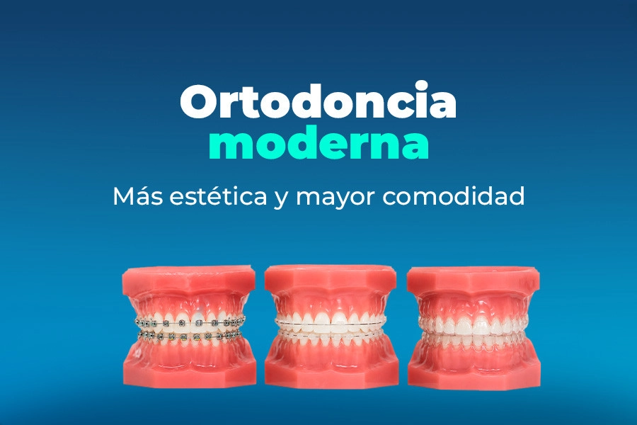 blog Ortodoncia moderna: Más estética y mayor comodidad