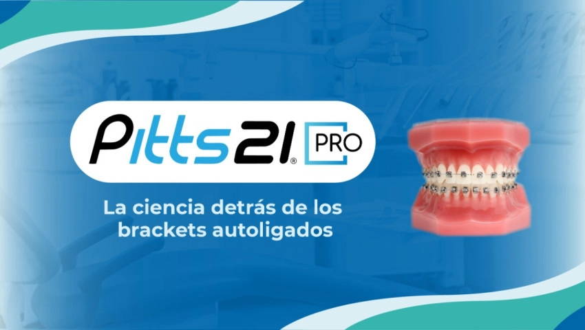 Pitts21 Pro: La ciencia detrás de los brackets autoligados