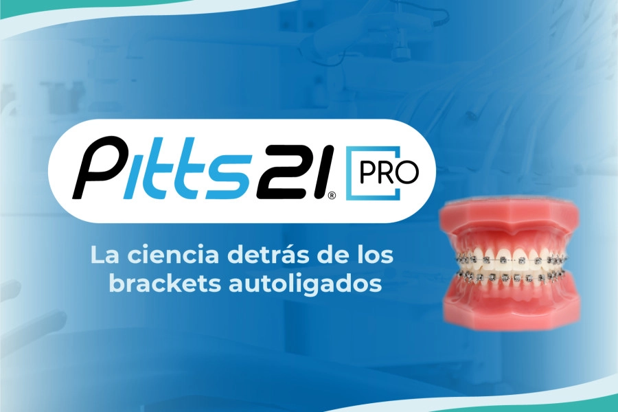 blog Pitts21 Pro: La ciencia detrás de los brackets autoligados