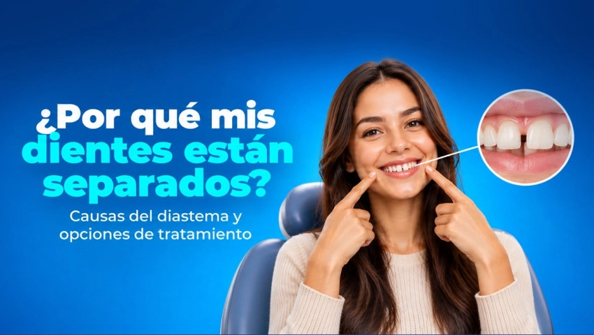 ¿Por qué mis dientes están separados? Causas del diastema y opciones de tratamiento