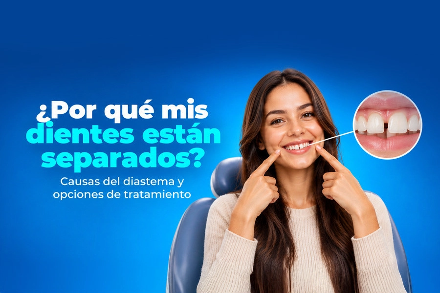 blog ¿Por qué mis dientes están separados? Causas del diastema y opciones de tratamiento