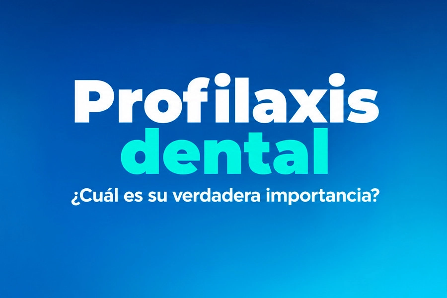 Recent post Profilaxis dental ¿Cuál es su verdadera importancia?