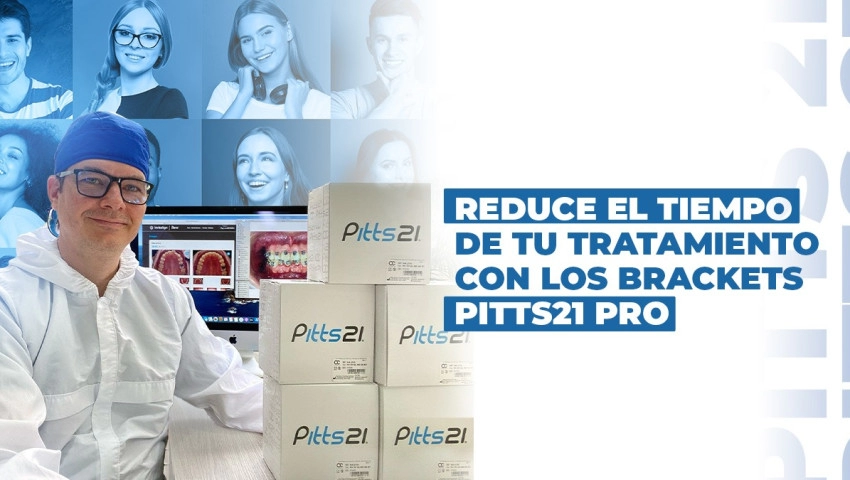 ​​Reduce el tiempo de tu tratamiento con los Brackets Pitts21 Pro