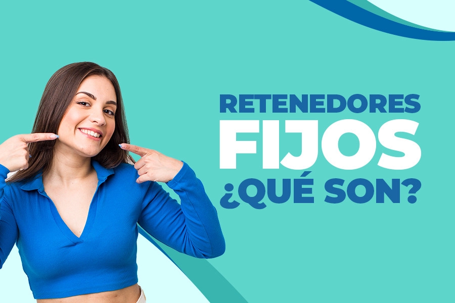 blog Retenedores fijos ¿Qué son?