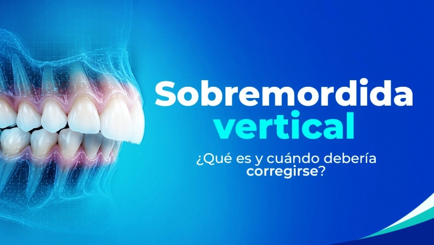 Sobremordida Vertical ¿Qué es y cuándo debería corregirse?