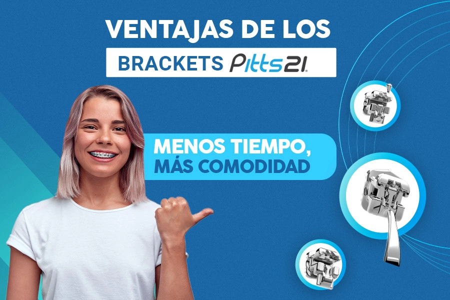blog Ventajas de los Brackets Pitts21: Menos Tiempo, Más Comodidad